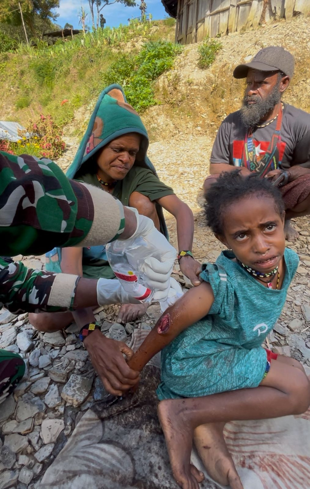 Tiga Warga Distrik Sinak Terluka Akibat Penembakan OPM, Dievakuasi dengan Bantuan TNI dan Warga